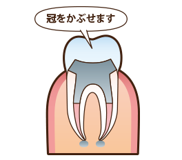 デンタルクリニック伏木 日野旭が丘 一般歯科 歯周病