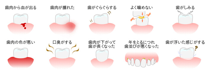 デンタルクリニック伏木 日野旭が丘 一般歯科 歯周病